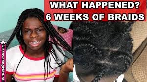 The normal box braids may be the best option when you want to play it safe. Box Braids Hair Growth Results Novocom Top