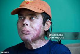 24 Mountain Ski Patrolman Stock Photos, High-Res Pictures, and Images