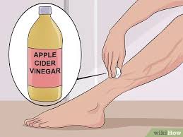 3 Ways To Get Rid Of Varicose Veins Wikihow