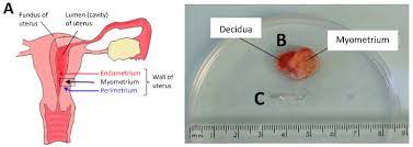 The myometrium is the muscular wall of the uterus. Human Myometrial Biopsy Dissection A A Diagram Of The Human Uterus Download Scientific Diagram