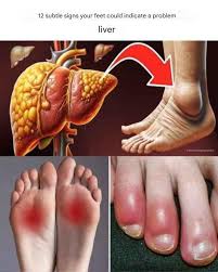 12 foot symptoms that may indicate a liver problem