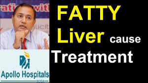 Fatty Liver Symptoms Complications And Treatment