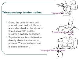 Assessment Of The Nervous System 230 Nurs Ppt Download