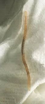 Those are in the early stage. Semi Transparent Worm With Spots Is A Millipede All About Worms