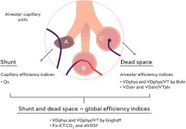 The definition of pure dead space is. Volumetric Capnography Lessons From The Past And Current Clinical Applications Critical Care Full Text