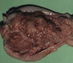 Papillary lesions are also present. Tumors Of The Urinary System Veterian Key