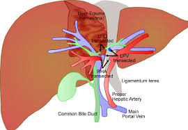 Learn about portal vein mesenteric arteries with free interactive flashcards. Image Of Initial Injuries Suffered Left Hepatic Duct Lhd Right Download Scientific Diagram
