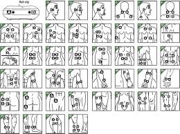 43 Disclosed Tens Electrode Placement Chart Pdf