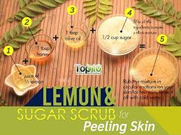 Home Remedies For Peeling Skin Top 10 Home Remedies Peeling Skin Lemon Skin Homemade Skin Care
