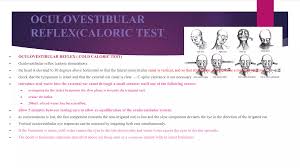 Image result for Oculovestibular Testing