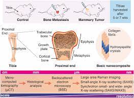 Multiscale Characterization Of The Mineral Phase At Skeletal Sites Of Breast Cancer Metastasis Pnas