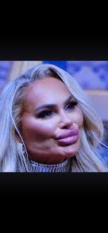 Baby Minthira recovering and possibly going home soon