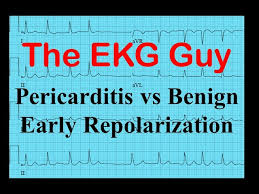 Image result for Early Repolarization
