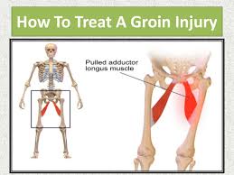 Gracilis is superficial and is. How To Treat A Groin Injury