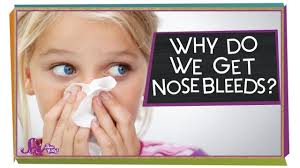 Why Do We Get Nosebleeds How To Become Nose Bleeds Working With Children