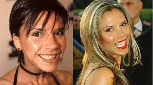 35 Celebrities With Veneers: Before and After Transformations