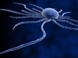 Le cancer de l'estomac est une forme de cancer se développant aux dépens des tissus de l'estomac. Cancer De L Estomac Symptomes Traitement Definition Docteurclic Com