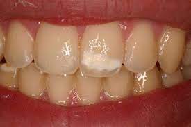 Pin On Kids Dental Health