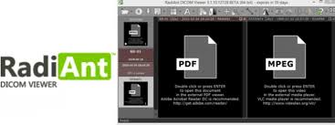 Interoperability woes can make it difficult to share and view medical images from disparate systems. Radiant Dicom Viewer For Mac Free Download Studyclever