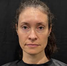 Guests' Stories • SEEN Medical Aesthetics