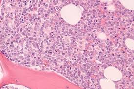 That will offer him some concept what the issue is. Novel Class Of Targeted Cancer Therapies Could Treat Myeloid Leukaemias