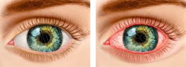 Image result for Blepharis obermeyerae