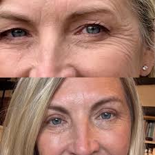 My before and 2 weeks after! 😀😀