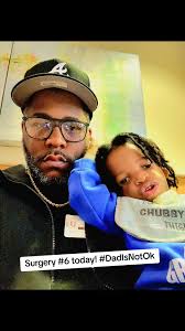 Treacher Collins Surgery Part 2