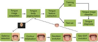 Outline Of A Computerized Model For Tongue Diagnosis And A