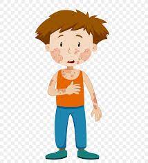 With eric edelstein, bobby moynihan, demetri martin, marc evan jackson. Clip Art Hives Vector Graphics Illustration Stock Photography Png 700x900px Hives Animation Art Cartoon Child Download