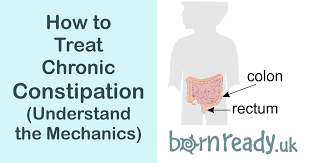 For all of these reasons, proper oversight by a medical professional is necessary with. The Mechanics Of Chronic Constipation And How To Treat It Born Ready Blog