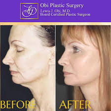 Obi Plastic Surgery Clinic