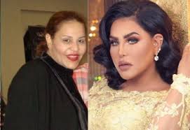 صور امل العوضي قبل عمليات التجميل لاحظوا كيف أصبحت بعد ! Ø¨Ø§Ù„ØµÙˆØ± Ø´Ø§Ù‡Ø¯ ÙƒÙŠÙ Ø§ØµØ¨Ø­ Ø´ÙƒÙ„ Ù‡Ø¤Ù„Ø§Ø¡ Ø§Ù„Ù†Ø¬Ù…Ø§Øª Ø¨Ø¹Ø¯ Ø§Ù„ØªØ¬Ù…ÙŠÙ„ Ø¬ÙØ±Ø§ Ù†ÙŠÙˆØ²