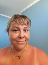 getting tanned in cloudy weather in iceland