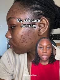 So happy my jouney has lead me here 💛 @Derm Intellect ® join our wait list  so that you are first in line for our launch ! #dermintellect  #hyperpigmentation #hyperpigmentationtreatment ...