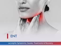 Image result for Acute Laryngitis