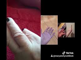 Healthprep.com has been visited by 1m+ users in the past month Video Regarding Can You Touch Your Index Finger To Your Pinky Finger Youtube