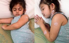 Animasi orang campak rubella tanda demam campak gambar paramyxovirus demam tinggi suhu demam vitamin a campak pencegahan campak leaflet campak campak vaccine virus gondong gambar konjungtivitis tulisan campak penyebab cacar demam campak rawatan. Myartis Com Myartis My Artis Kena Demam Campak Pengikut Ig Kongsi Petua Doa Kesembuhan Aaisyah