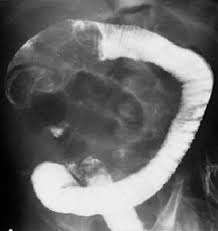 Pin On Radiology Signs