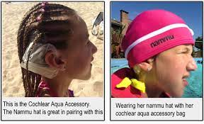 Pin On Asl And Cochlear Implants