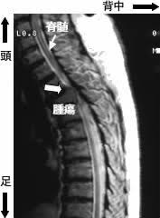 内科 脳神経内科 腎臓・高血圧内科 リウマチ・膠原病内科 循環器内科 糖尿病・代謝・内分泌内科 腫瘍・血液内科 呼吸器内科 接種 小児神経外来 皮膚科（小児診療） 小児一般外来 小児血液腫瘍外来 耳鼻咽喉科（小児診療） 産科 未熟児フォローアップ 眼科（小児診療） 小児循環器外来 小. Neuroinfo Japan è„Šé«„è…«ç˜