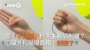Stanford系統 →type a(有影響到升主動脈) →type b(沒有影響到升主動脈). é  æ‰‹æŒ‡é ­ ç§'æ¸¬ä¸»å‹•è„ˆå‰é›¢ å¿ƒè‡Ÿå¤–ç§'é†«æ›çœŸç›¸ åˆ¥å‚»äº† Ettodayå¥åº·é›² Ettodayæ–°èžé›²
