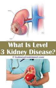 Epingle Sur Kidney Disease Stages