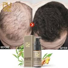 • don't wash your hair every day! Purc Fast Hair Growth Essence Oil Hair Loss Natural Ginger Extract Treatment Ebay