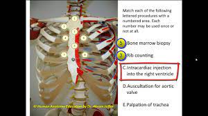 The ribs are elastic arches of bone, which form a large part of the thoracic skeleton. Surface Anatomy Of The Thorax Youtube
