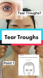 For treating tinnitus, some believe ginger helps relieve the situation in addition to acupressure points; What Period Cramps Pattern Do You Belong To Learnontiktok Tiktokdoc Acupuncturist Tcm Periodcramps Foryourpage Tiktok Laurel Acupuncture In Tiktok Exolyt