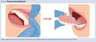 How long will dentures last? Principles Of Effective Oral And Denture Care In Adults Nursing Times