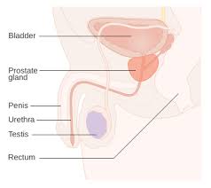 However, as with other types of cancer,. Prostate Cancer Wikipedia