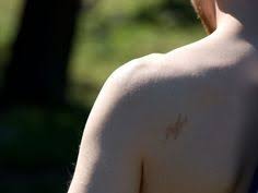 Birthmark On Leg Meaning What Does Your Birthmark Say About You Reincarnation And Past Lives Meaning Of Birthmarks Reasons For Birth Birthmark Reincarnation Birthmarks Past Life
