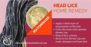 home remes head lice